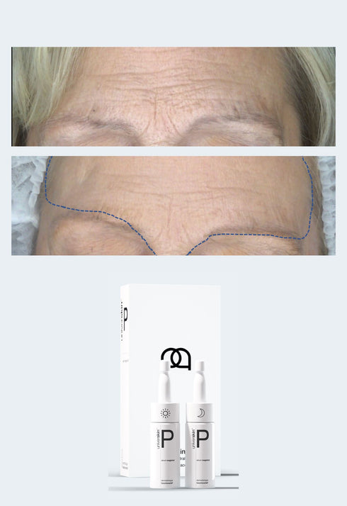 Personalised Skincare Medical Grade Smooth Skin Texture Skincare Treatment