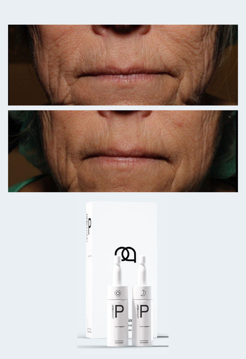 Personalised Skincare Medical Grade Oxidative Skin Skincare Treatment