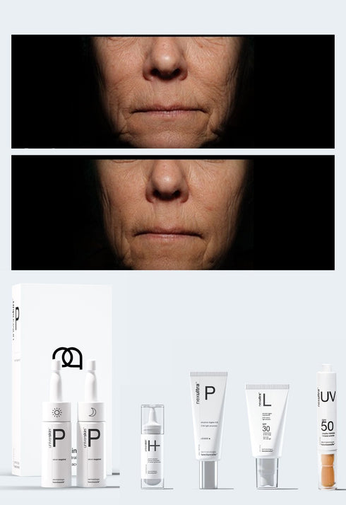 Personalised Medical Grade Prescription Skincare Treatment for Wrinkles & Lines complete package