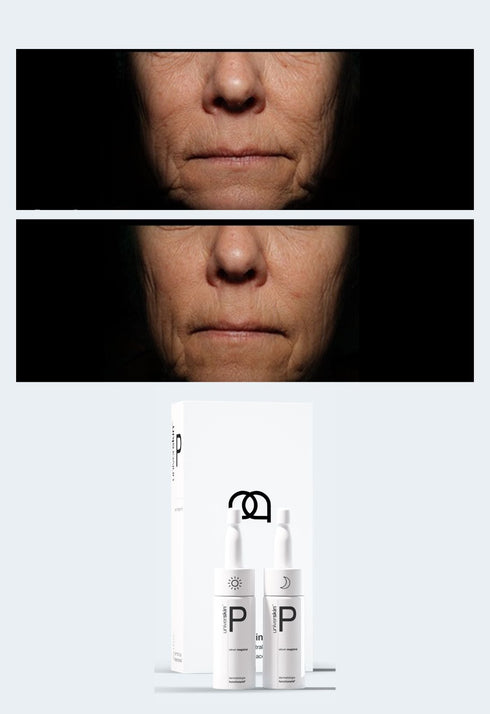 Personalised Skincare Medical Grade Anti-Wrinkles Skincare Treatment