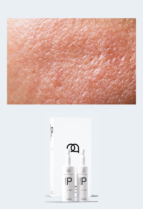 Personalised Skincare Medical Grade Oily Skin Skincare Treatment