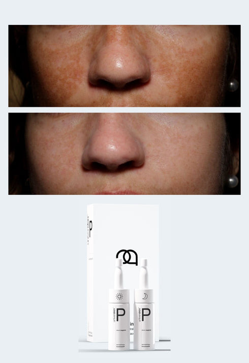 Personalised Skincare Medical Grade Open Pores Skincare Treatment