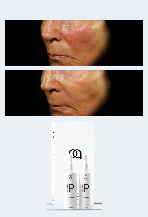 Personalised Skincare Medical Grade Redness Skincare Treatment