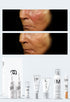 Personalised Medical Grade Prescription Skincare Treatment for Skin Redness complete package