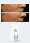 Personalised Skincare Medical Grade Reverse Skin Scarring Skincare Treatment