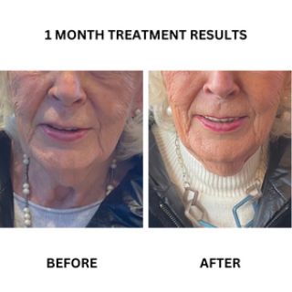 Before and after photographs from the existing "Reverse Ageing" - A Personalised Skincare Package of Medical Grade Skincare to Reverse the Signs of Ageing banner.